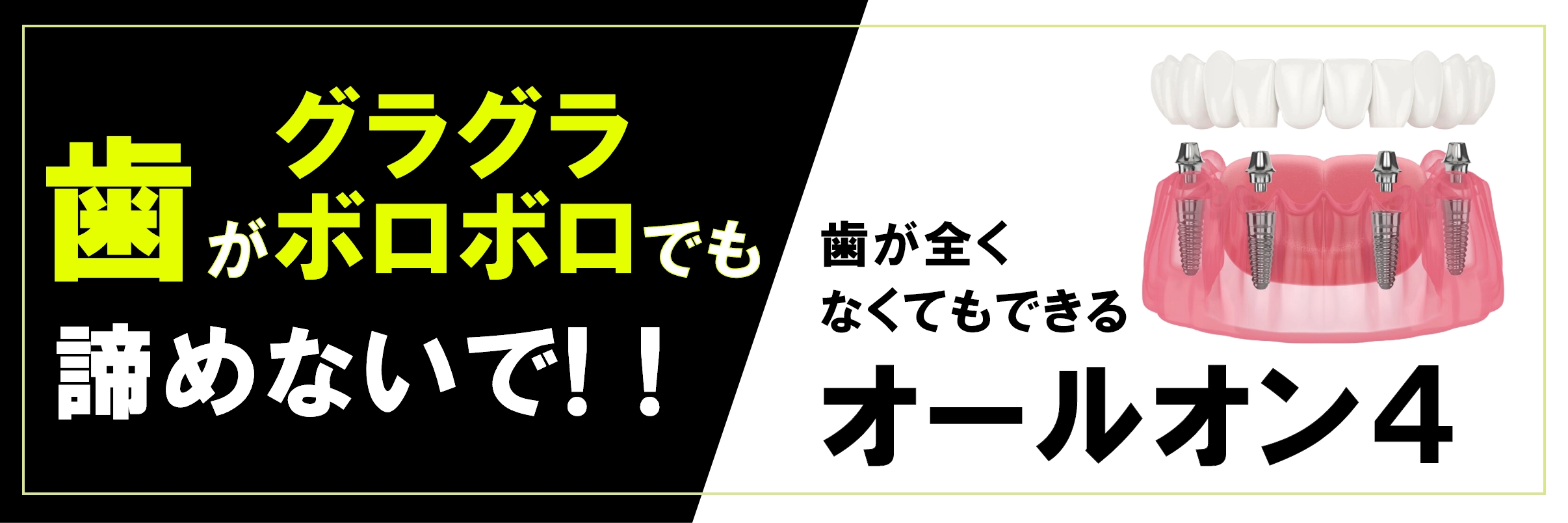 オールオン4